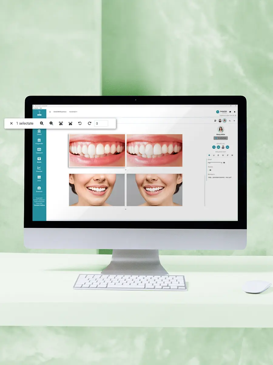 Caracteristica Editarea fotografiilor din modulul software SmileSIM Studio Editarea fotografiilor caracteristica aplicației software