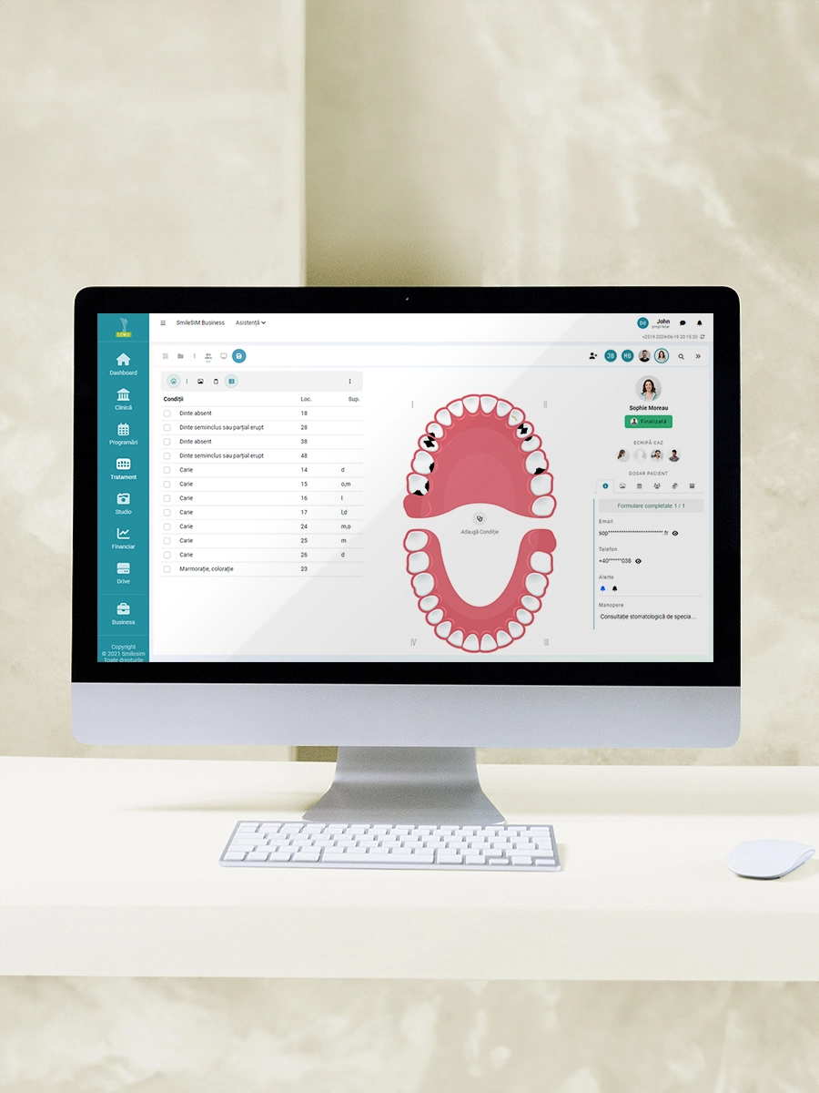 Caracteristica Grafic Dentar din modulul software SmileSIM Plan de Tratament Grafic Dentar caracteristica aplicației software